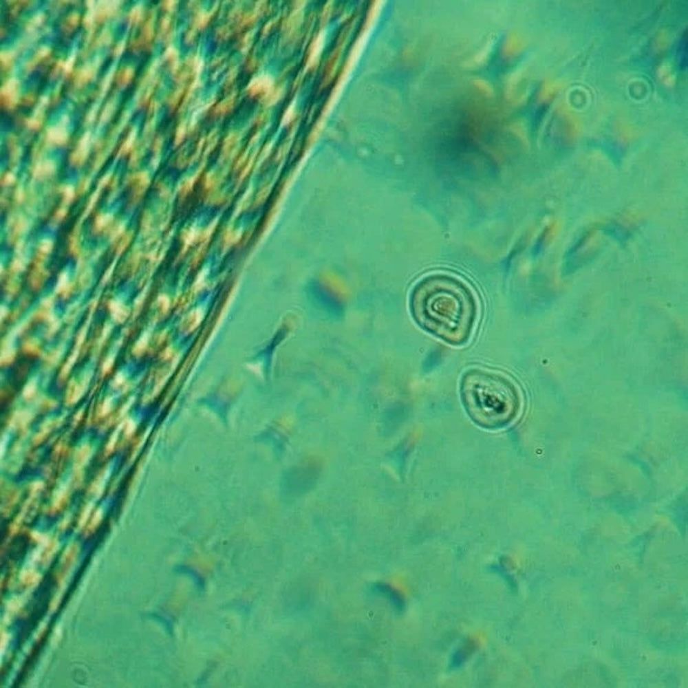 Zero Skin Beruhigende Augencreme mit CBD, 1% Cannabidiol für trockene Haut