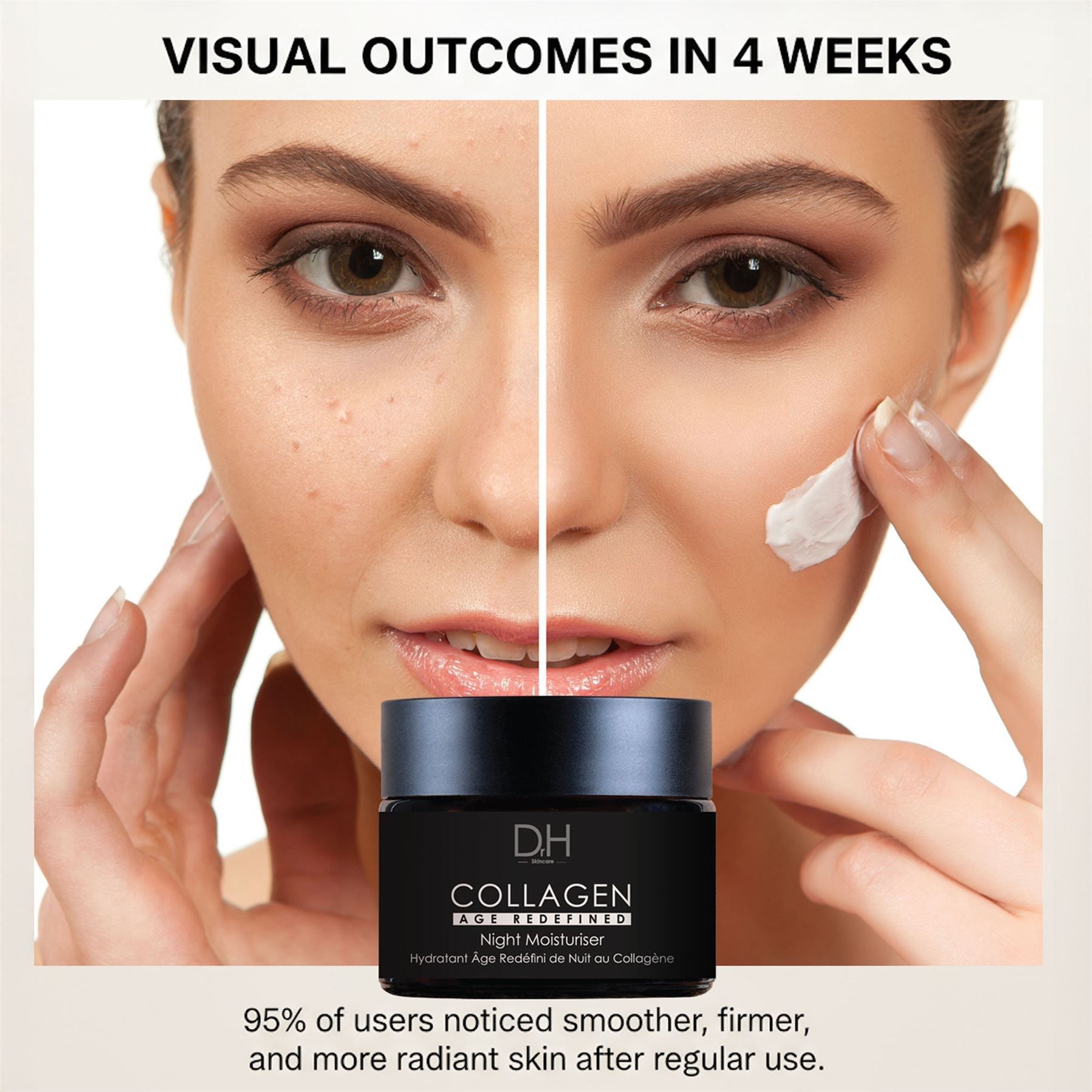 Vorher-Nachher-Vergleich der Haut mit Dr. H Collagen Anti-Age Nachtcreme.