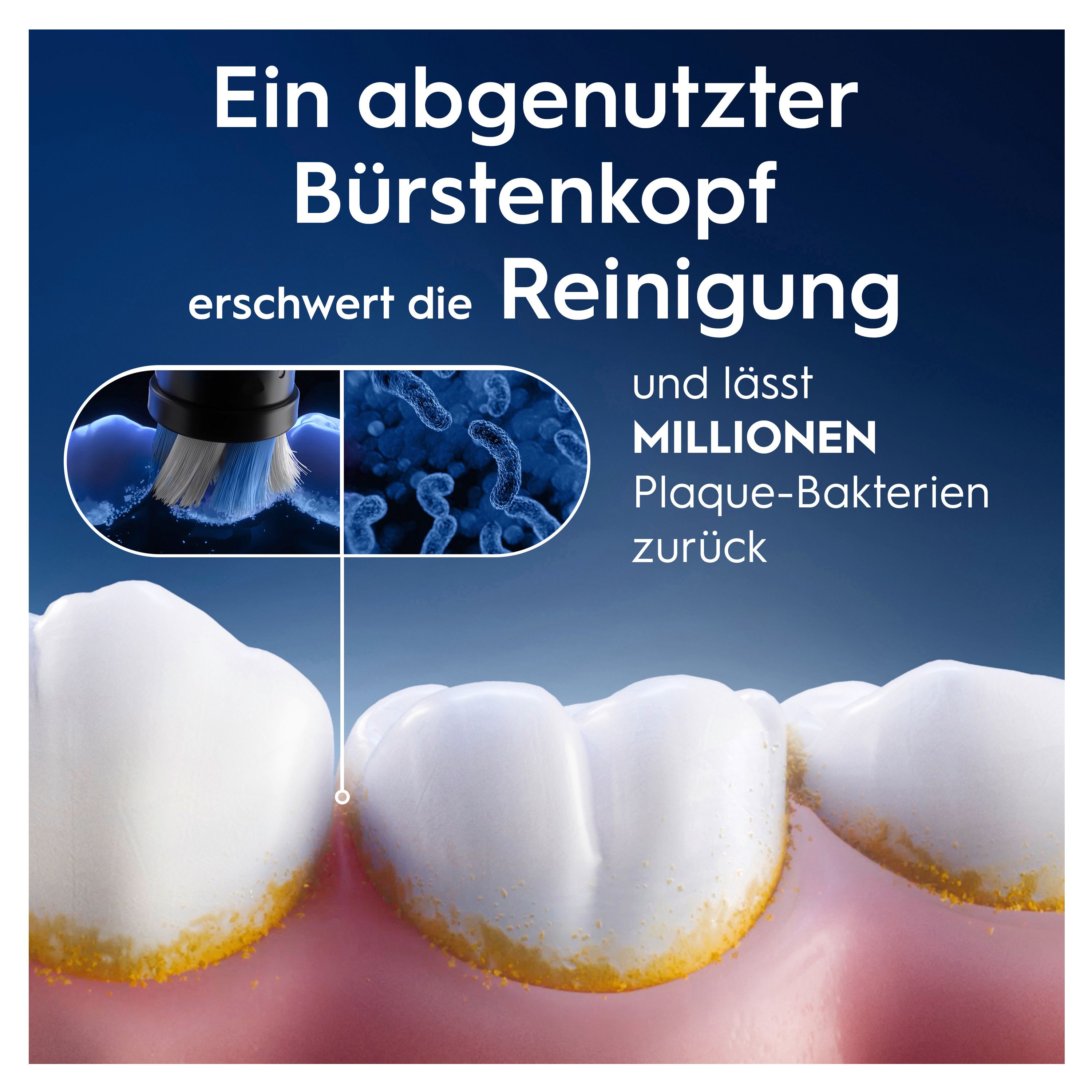 Nahaufnahme von Zähnen und einer Zahnbürste. Text: Ein abgenutzter Bürstenkopf erschwert die Reinigung.