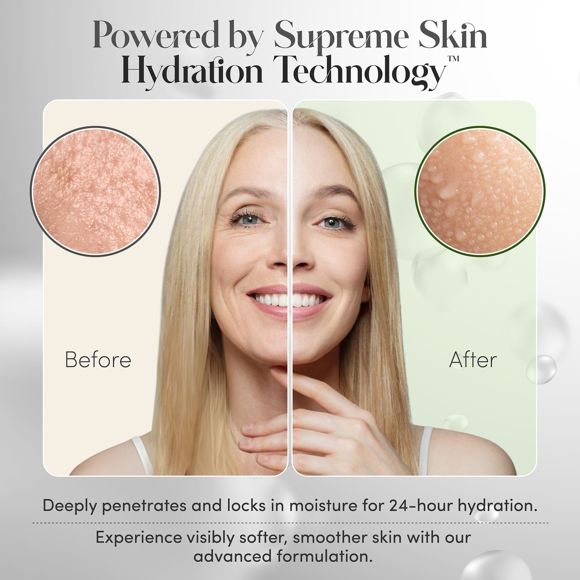 Vorher-Nachher-Vergleich. Frau mit Gesichtshälfte mit Hautunreinheiten und glatter Haut. Text: Supreme Skin Hydration Technology.