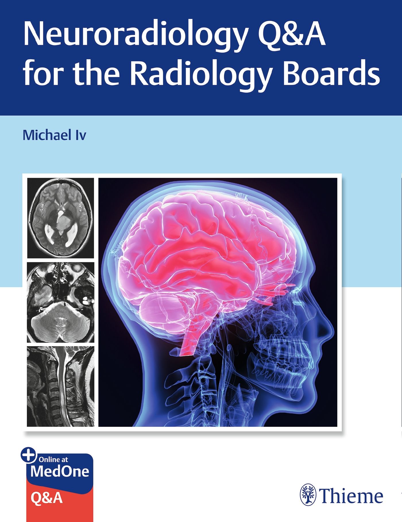 Neuroradiology Q&A For The Radiology Boards 1 St - Shop Apotheke