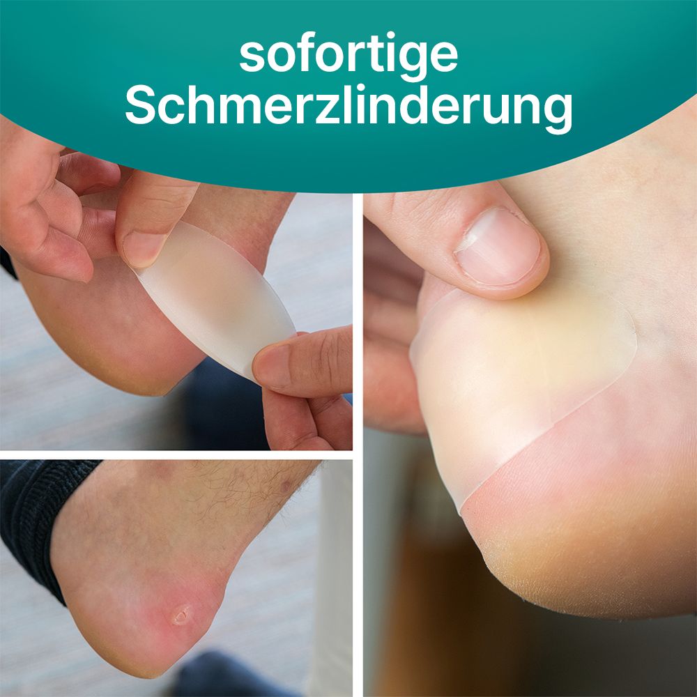 Fuß mit Hydrokolloid-Pflaster. Anwendung auf Ferse und Zehen. Text: sofortige Schmerzlinderung.