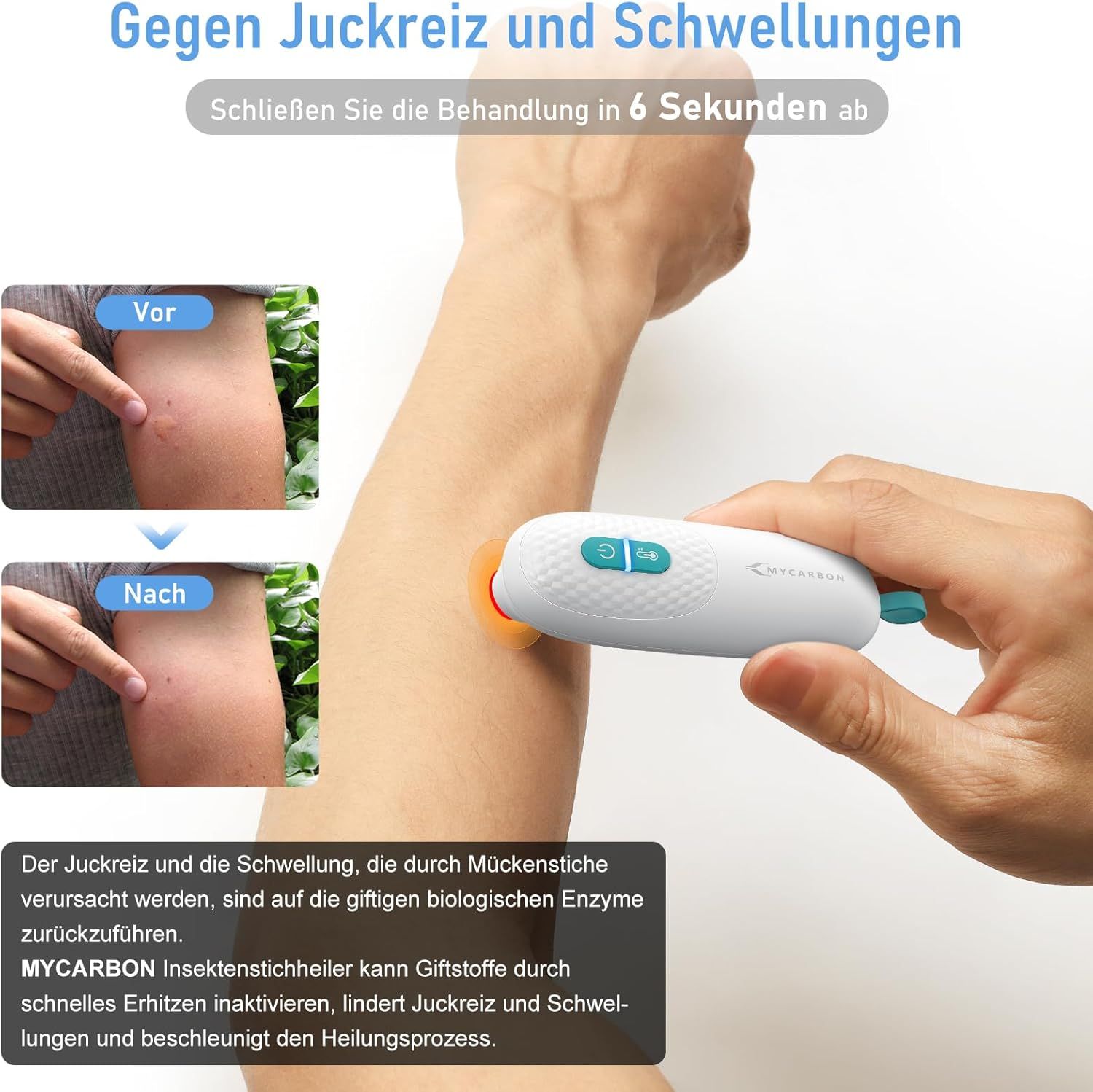 MYCARBON Insektenstichheiler, klein und handlich Mückenstich Hitzestift