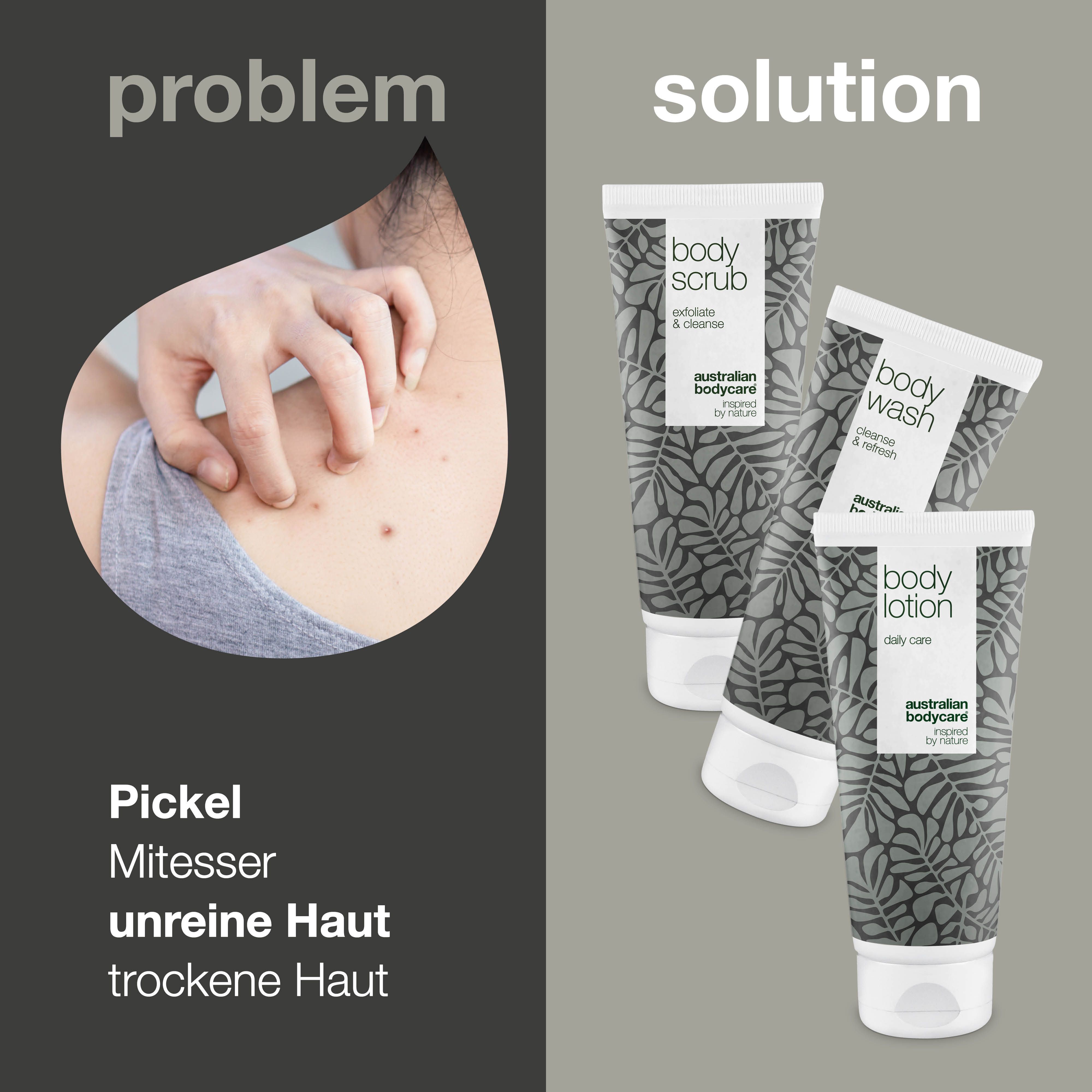 Problem: Pickel, Mitesser, unreine Haut. Lösung: Drei Tuben mit Körperpflegeprodukten.