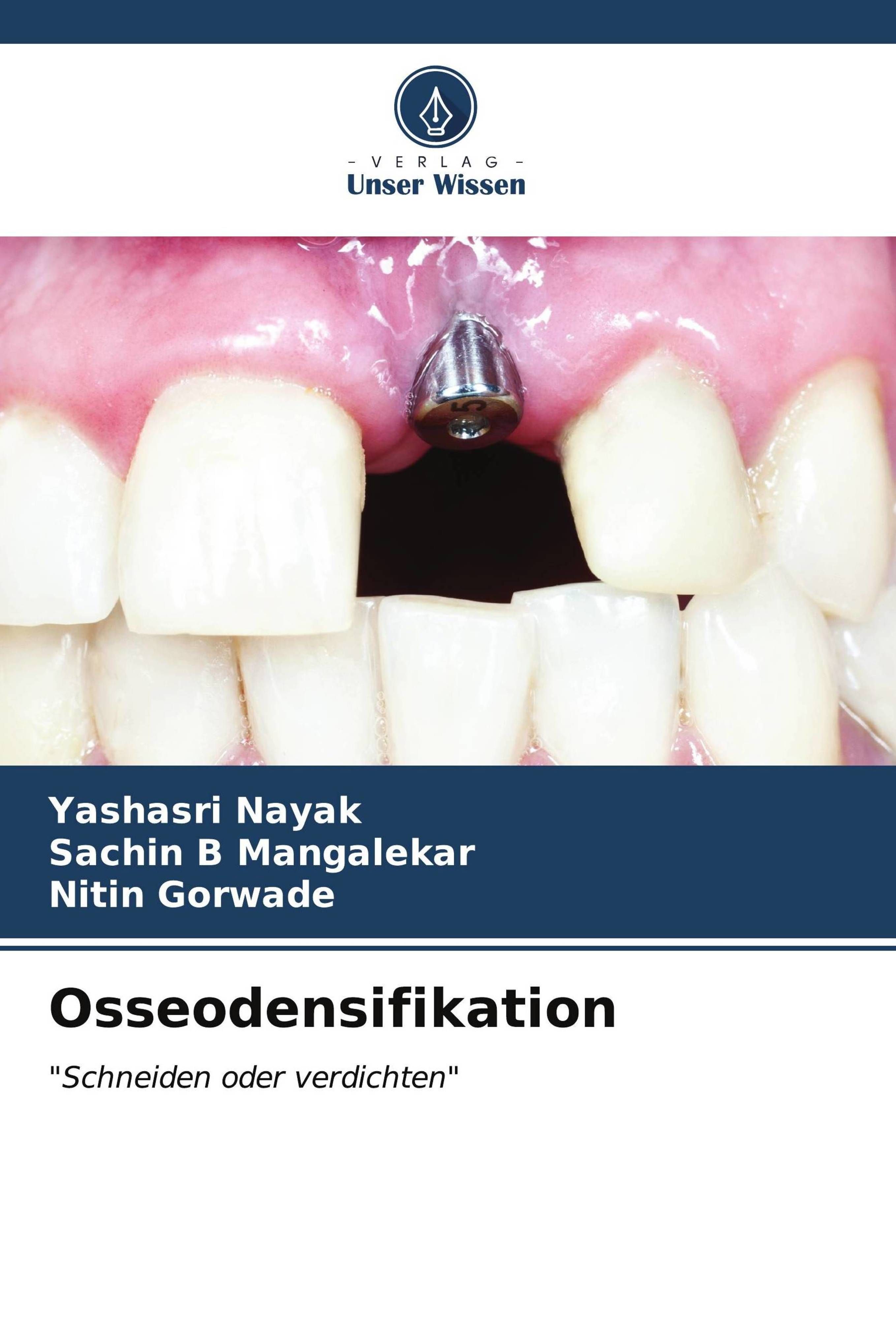 Osseodensifikation "Schneiden oder verdichten"