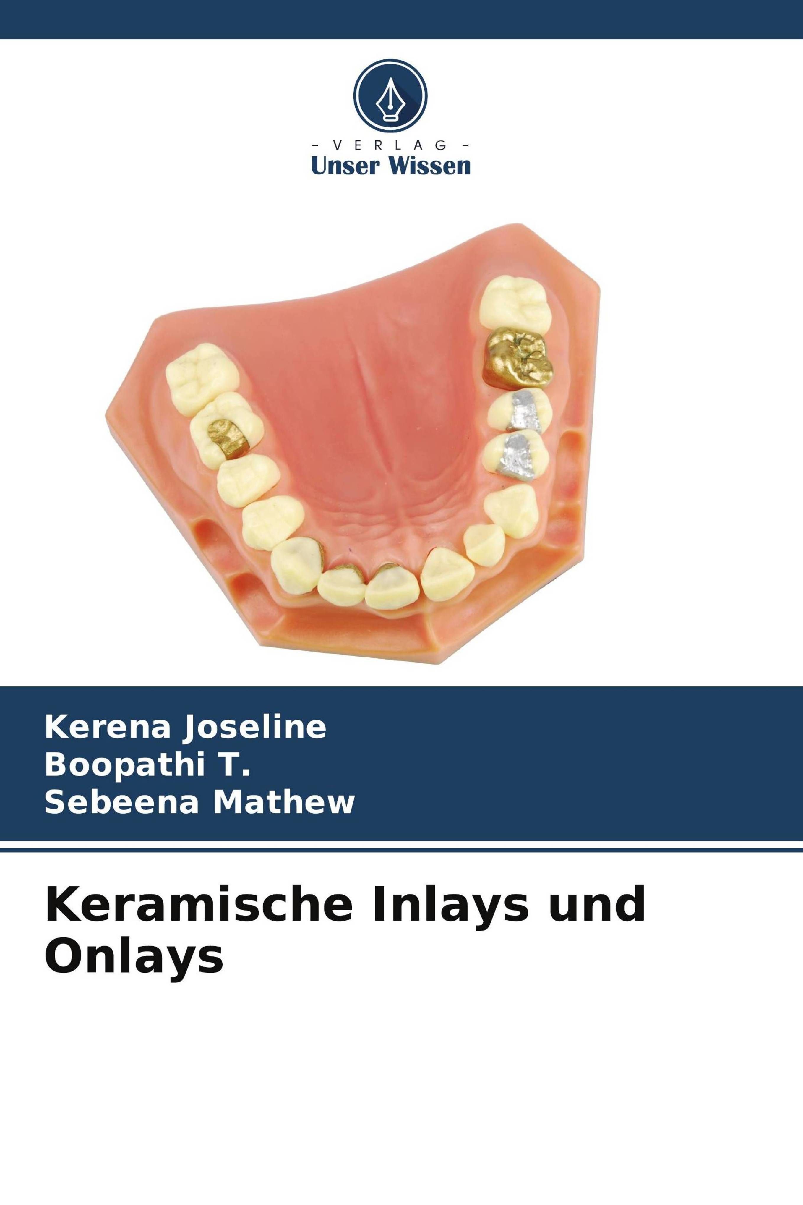 Keramische Inlays und Onlays DE
