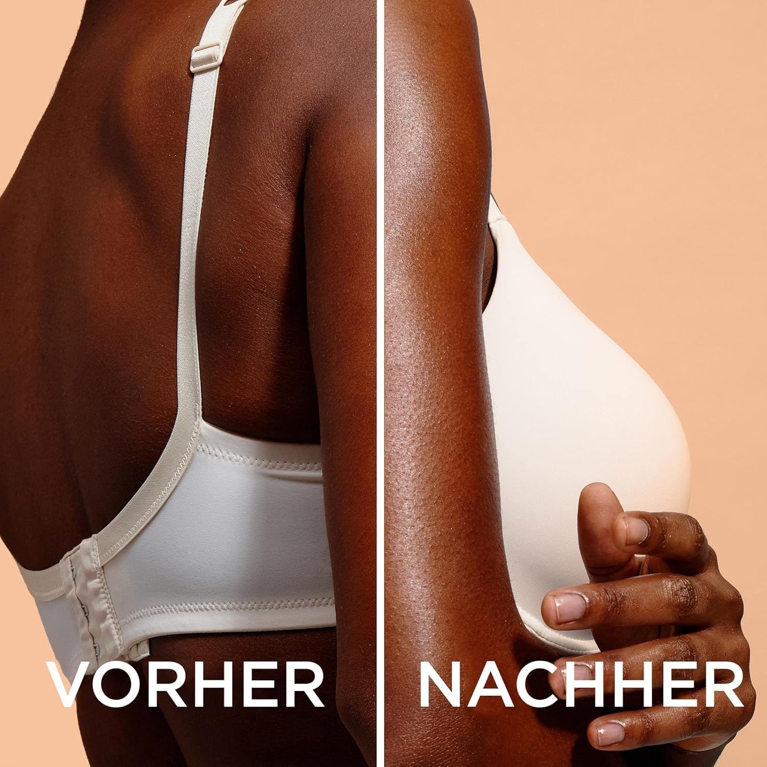 Vorher-Nachher-Vergleich. Dunkelhäutige Person im weißen BH. Links: Rückansicht. Rechts: Seitenansicht. Text: Vorher, Nachher.