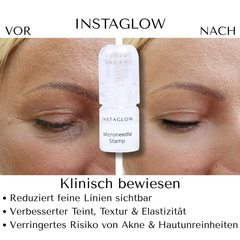 Anleitung zur Anwendung des Instaglow-Produkts. Schritte 1-6. Serum, Stempel, Anwendung.