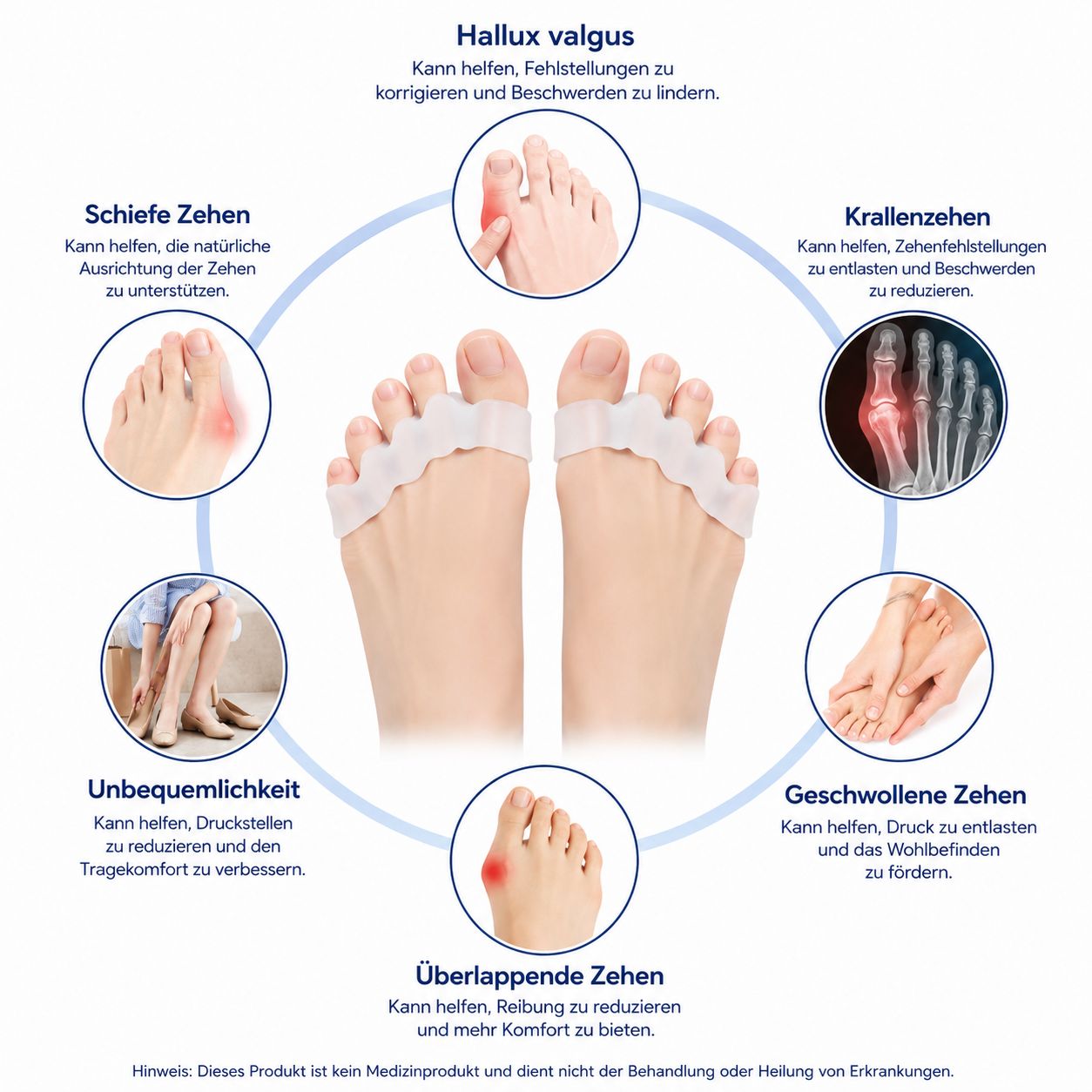 Silikon-Zehentrenner helfen bei Hallux valgus, schiefen Zehen, Ballenzehen und überlappenden Zehen.
