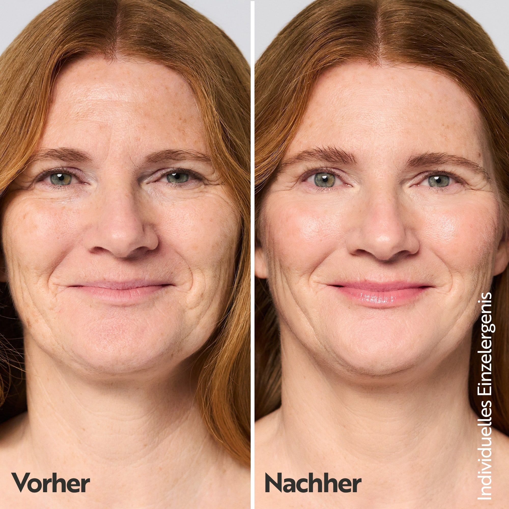 Vorher-Nachher-Vergleich einer Frau, die M. Asam Hautglättendes Serum verwendet.