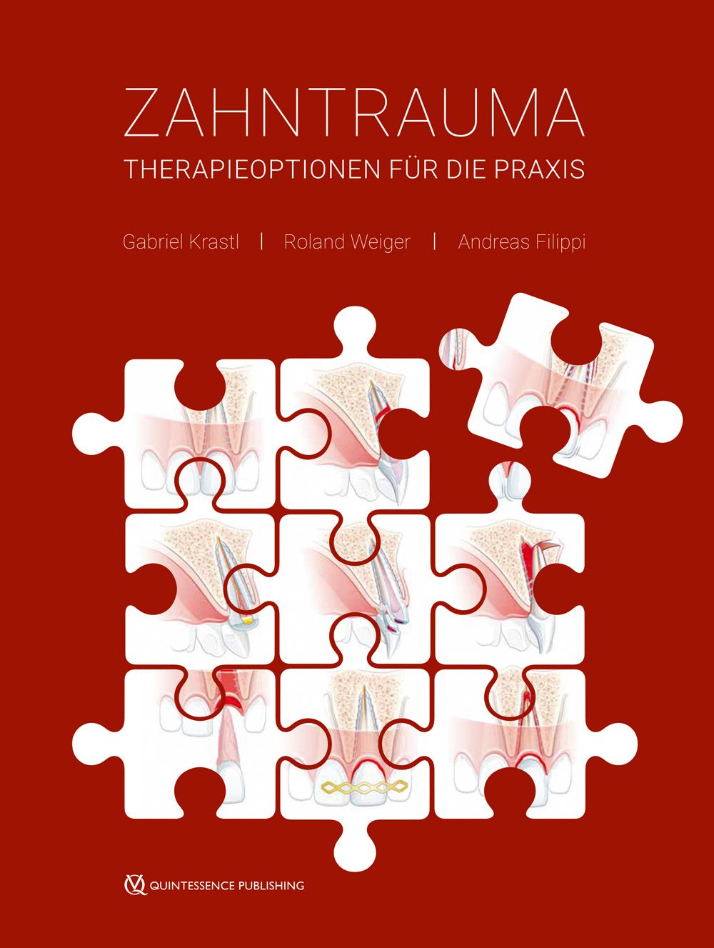 Buchcover: "Zahntrauma". Titel und Autoren auf rotem Hintergrund. Puzzleteile mit Zahnillustrationen.