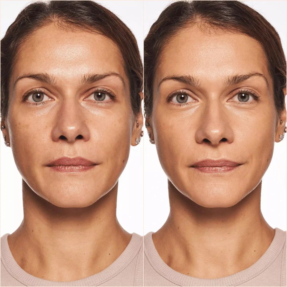 Gesicht vor und nach dem Auftragen von Foundation. Deutlicher Unterschied im Hautton und der Deckkraft.