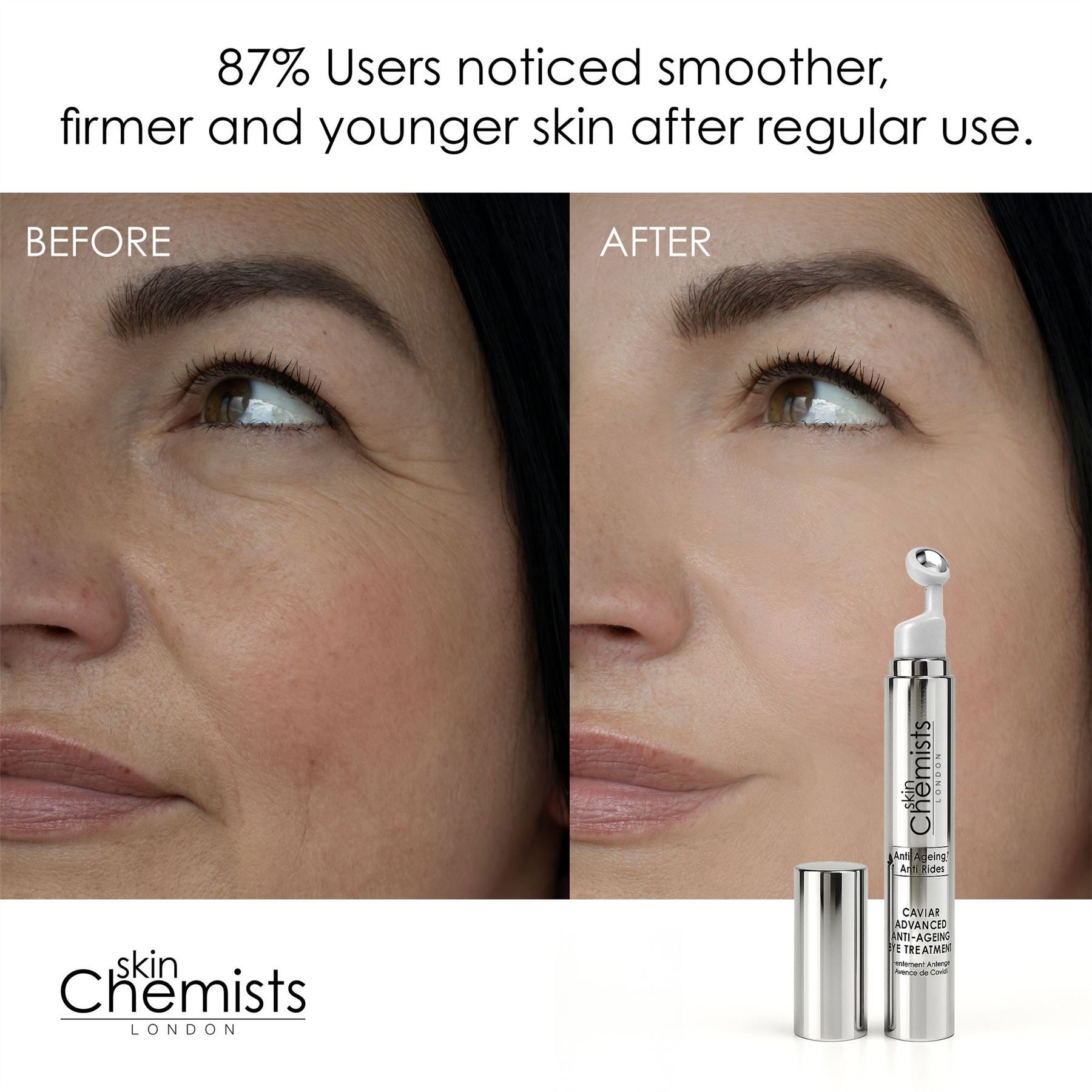 Vorher-Nachher-Vergleich von Haut mit SkinChemists Augenpflege-Serum.