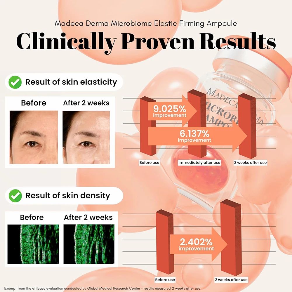 Vorher-Nachher-Vergleich von Haut. Diagramme zeigen Verbesserungen. Text: MADECA DERMA Microbiome Elastic Firming Ampulle. Klinisch bewiesen.