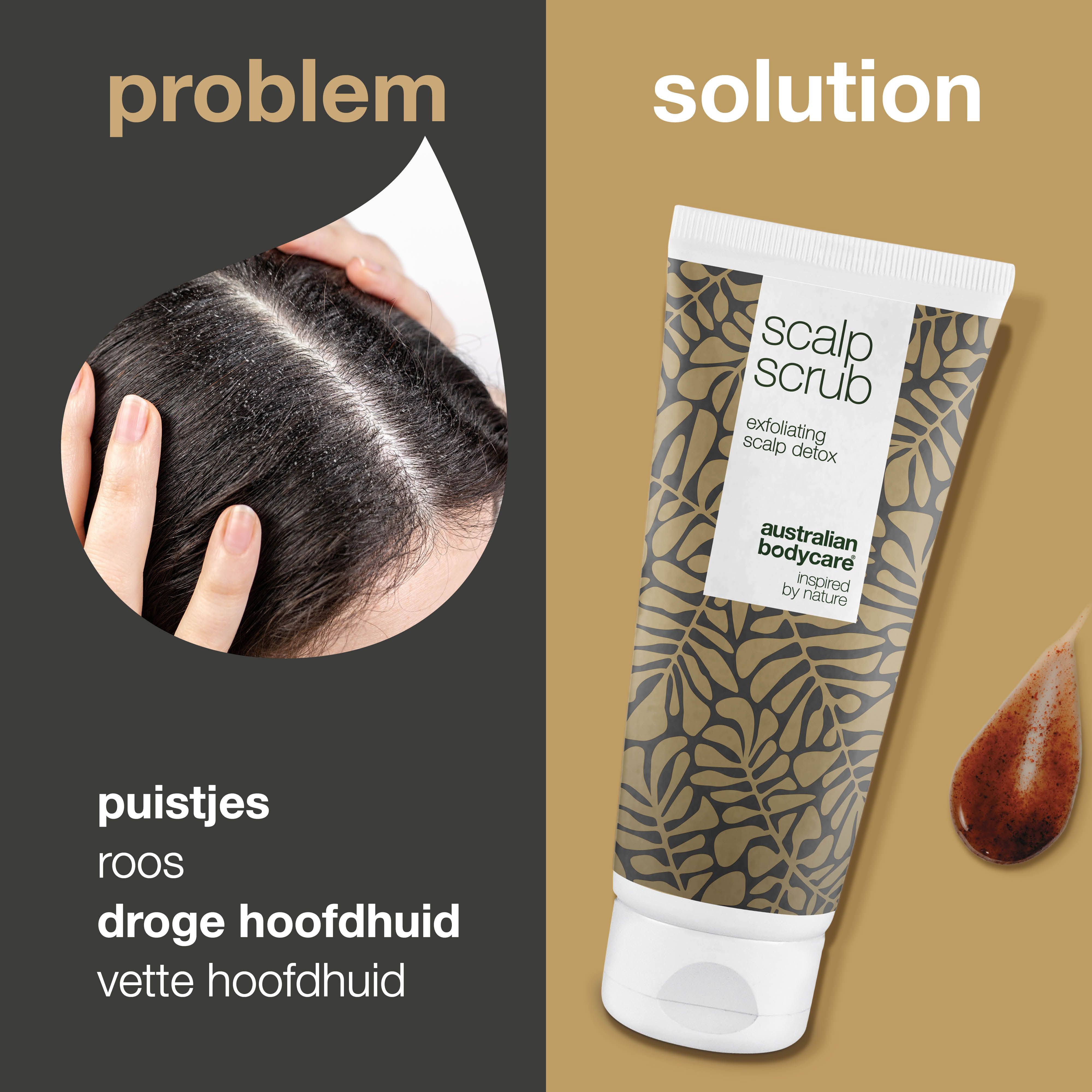 Vergelijking: probleem (hoofdhuid) en oplossing (tube). Tube: Scalp Scrub, Australian Bodycare. Bruine peelingdruppels.