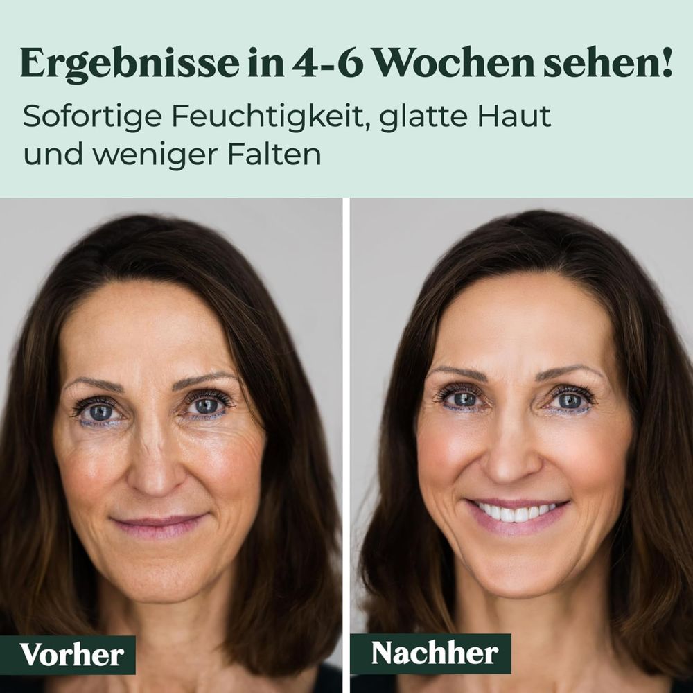 Vorher-Nachher-Vergleich. Zwei Frauenporträts. Text: Ergebnisse in 4-6 Wochen sehen! Sofortige Feuchtigkeit, glatte Haut und weniger Falten.