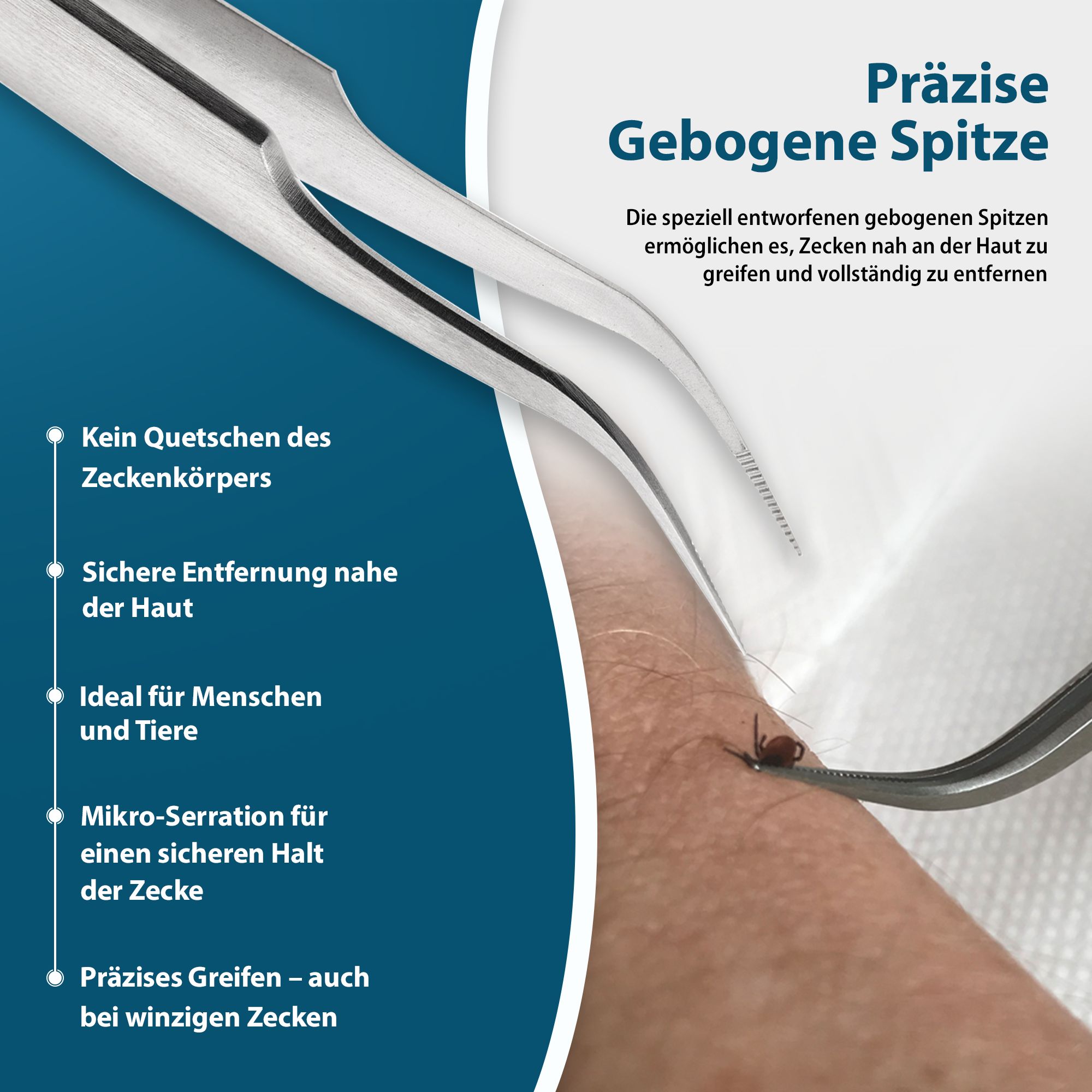 Präzise, gebogene Spitze der Zeckenzange für sicheres Greifen nahe der Haut.