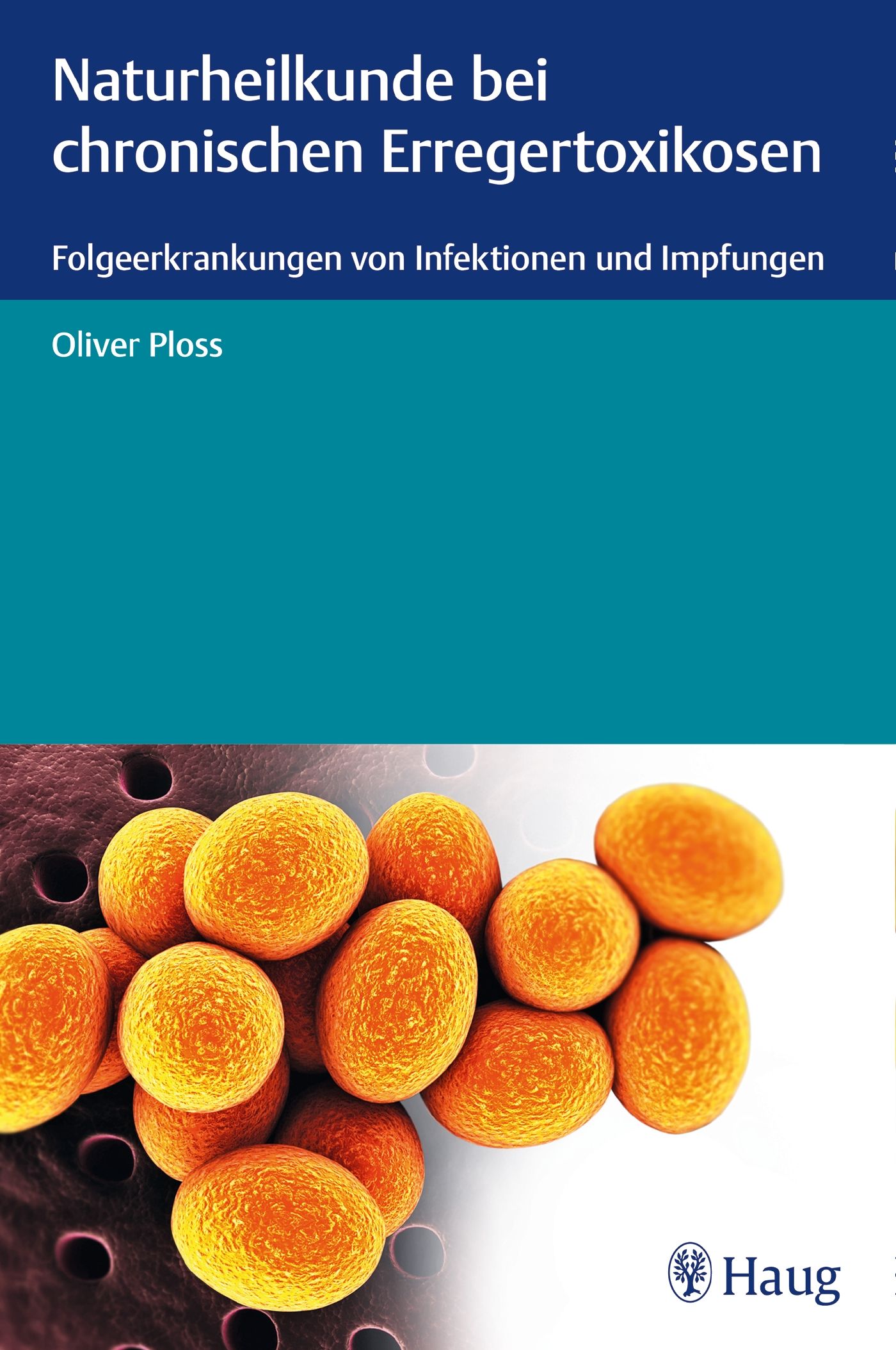 Buchcover: Naturheilkunde bei chronischen Erregertoxikosen. Autor: Oliver Ploss. Verlag: Haug. Abbildung von Zellen.